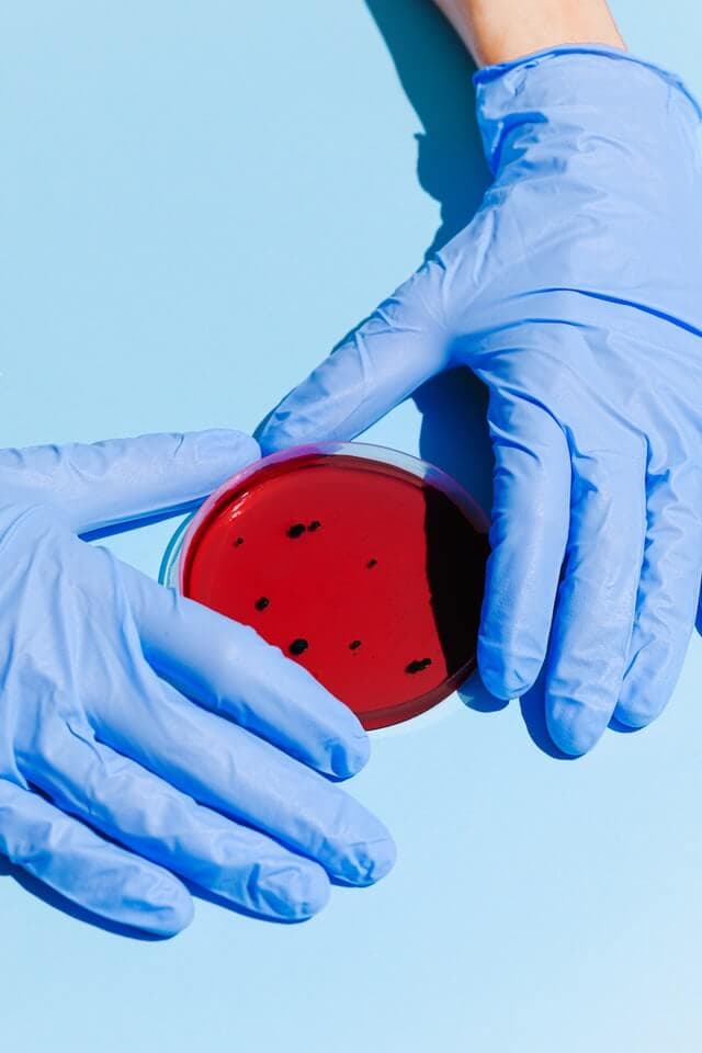 Sample handling at the lab